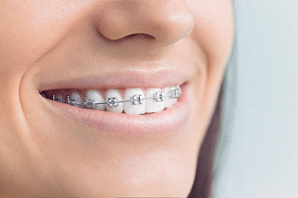 Best Wisdom Tooth Removal  in Macarthur, WV